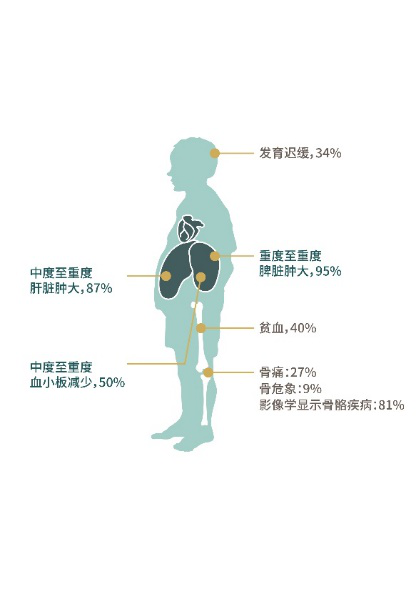 高危代谢病新生儿酶学筛查