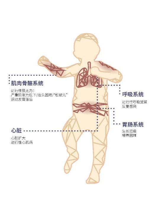 高危代谢病新生儿酶学筛查